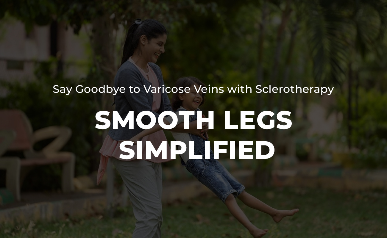 Sclerotherapy